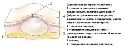 Hogy nyomjuk wen Hogy nyomjuk wen