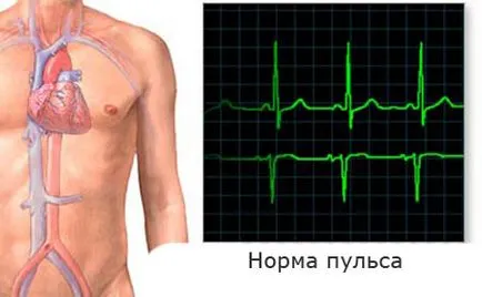 Heartbeat, hogy rendben van Heartbeat, hogy rendben van