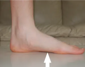onychomycosis köröm kezelés onychomycosis köröm kezelés