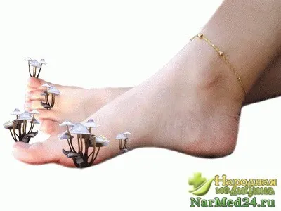 onychomycosis köröm kezelés