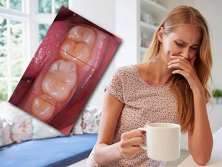 Zsibbadt fogfájás