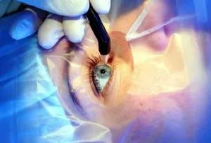 Nystagmus, mi ez