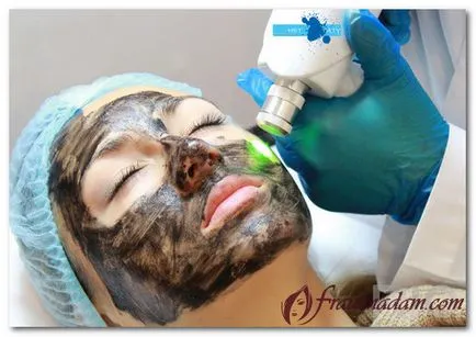 Peeling otthon gyümölcssavak