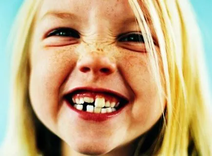periodontitis kezelésére gyermekeknél