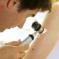 Miért mol viszket Miért mol viszket