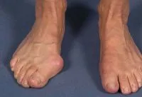 Ön bolite lábak