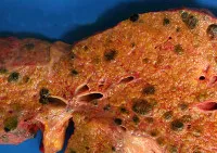 Toxikus hepatitis amit
