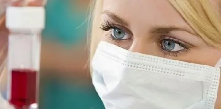 Toxikus hepatitis amit Toxikus hepatitis amit
