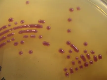 Fagocita elmélet immunitás