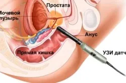 Ultrahang diagnosztika
