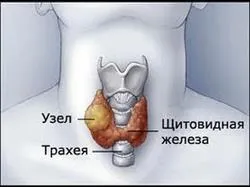 Ha a pajzsmirigy csökkent Ha a pajzsmirigy csökkent