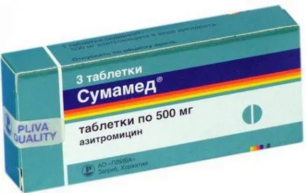 Mirigyláz kezelés otthon