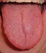 A nyelv, mint az emberi test