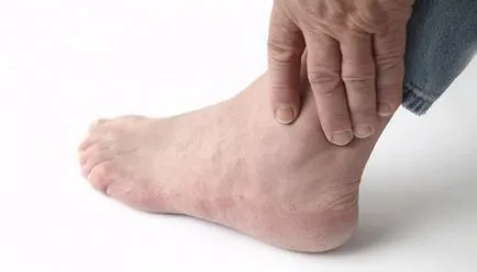 Allergiás Arthritis okai, tünetei, kezelése gyermekeknél és felnőtteknél (kezelés) Allergiás Arthritis okai, tünetei, kezelése gyermekeknél és felnőtteknél