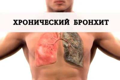 Bronchitis típusok, mint veszélyes szövődmény és milyen orvos kezel