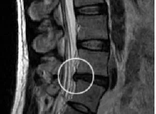 Mi a különbség egy MRI CT eseteket, amelyekben MRI jobb, mint a CT (különböző) Mi a különbség egy MRI CT eseteket, amelyekben MRI jobb, mint a CT
