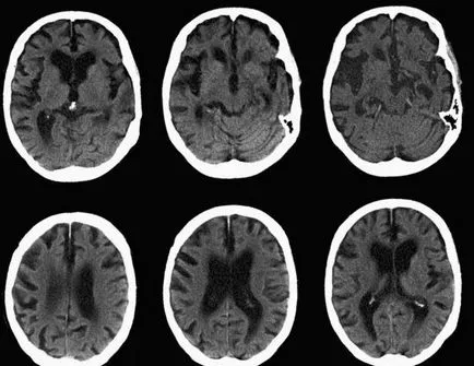 Mi a különbség egy MRI CT eseteket, amelyekben MRI jobb, mint a CT (jobb) Mi a különbség egy MRI CT eseteket, amelyekben MRI jobb, mint a CT