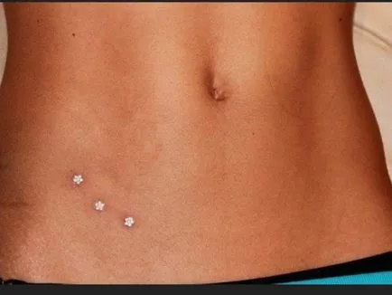 Mi a bőrön implantátum - hogyan ustananovit és gondozás, tattoografika