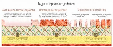 Tört termoliz- mi ez, a természet és az eljárás hatását (frakionny) Tört termoliz- mi ez a lényege az eljárás és a kereset