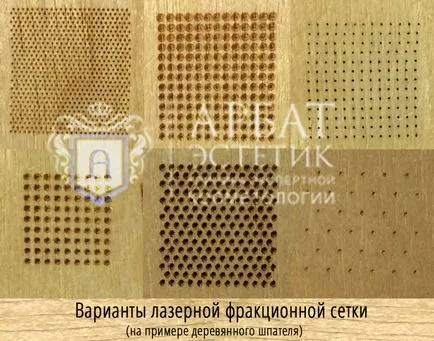 Tört termoliz- mi ez, a természet és az eljárás hatását (eljárás) Tört termoliz- mi ez a lényege az eljárás és a kereset