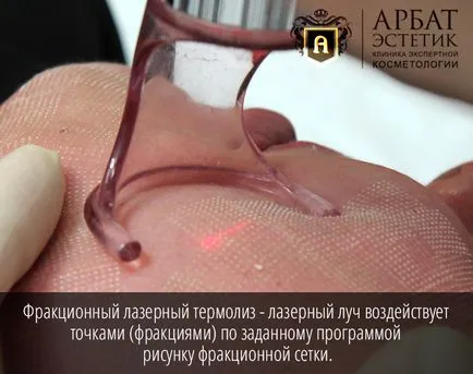 Tört termoliz- mi ez, a természet és az eljárás hatását (termolízis) Tört termoliz- mi ez a lényege az eljárás és a kereset