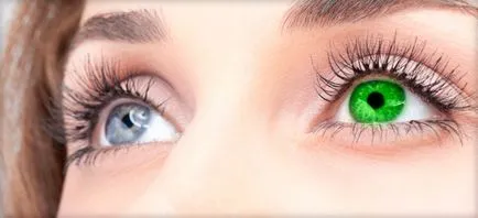 Szem különböző színű (heterochromia), az azt jelenti, hogy az okok raznoglaziya (fotó)