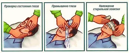 A altat a szem A altat a szem