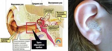 Hogyan csepegtető hidrogén-peroxiddal a fül a fül tisztítása a közlekedési dugók, a gyermek (peroxid) Hogyan csepegtető hidrogénperoxid fül fül tisztítása a közlekedési dugók a gyermek