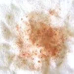 Hogyan mossa után bárányhimlő Zelenka gyorsan, anyám puskát (Zelenka) Hogyan mossa után bárányhimlő Zelenka gyorsan, anyám puskát