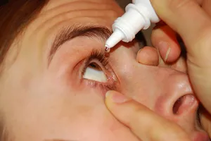Hogyan kell szedni a fájdalom szemcseppet adott alkalmazás jelent becseppentéskor szem (szemészeti szemcsepp érzéstelenítő procaine) Hogyan kell szedni a fájdalom szemcseppet adott alkalmazás jelent szemet becsepegtetés