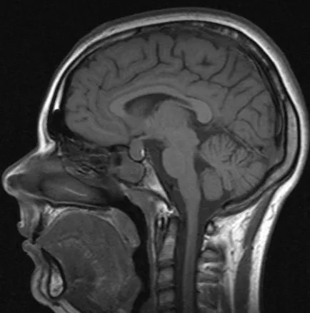 Hogyan lehet ellenőrizni a hajók az agyban diagnosztikai eljárásokat (diagnosztika) Hogyan lehet ellenőrizni a hajók az agyban diagnosztikai módszereket