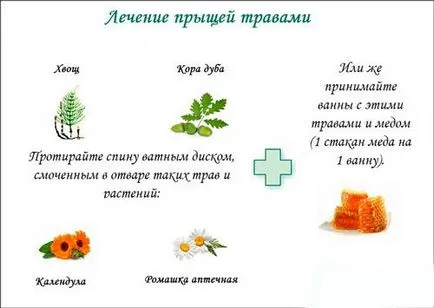 Hogyan lehet eltávolítani a pattanások a hátán és a válla gyorsan otthon