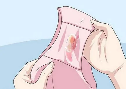 Chlamydia és a terhesség kezelés