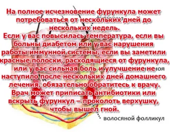Hogyan lehet gyógyítani a forraljuk otthon - a leghatékonyabb receptek (gyógyítás) Hogyan lehet gyógyítani a forraljuk otthon - a leghatékonyabb receptek