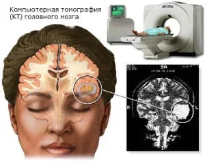A CT-vizsgálat - minden, amit tudni akartál a modern diagnosztikai módszerek