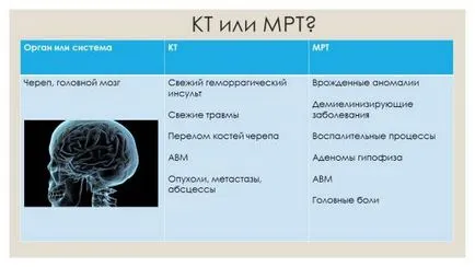 CT és MRI a különbség, hogy mi a különbség, akkor jobb (különbség) CT és MRI a különbség, hogy mi a különbség, melyik a jobb