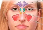 sinusitis kezelésére népi jogorvoslati otthon
