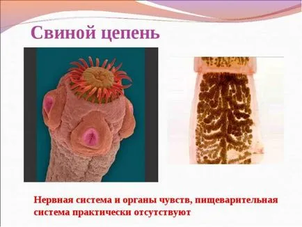 Galandféreg emberben a tünetek és jelek, fotó (tünetek) Galandféreg emberben a tünetek és jelek, fotók