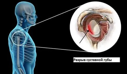MRI a vállízület, amely megmutatja, képzés, felolvasások