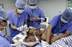 Neurofibromatózis - okai, típusai, tünetei, a kezelés, megelőzés