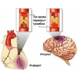 Kórház Kemerovo agy MRI (agy) Kemerovo Regional Hospital MRI az agy