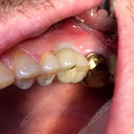 Tedd szép fogak Moszkvában