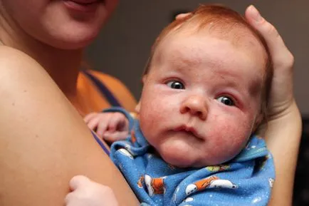 Az első szilárd ételek, hogyan lehet belépni, és hogyan kell elindítani kiegészítő táplálás baba (szabályok) (valami) Az első szilárd ételek, hogyan lehet belépni, és hogyan kell elindítani kiegészítő táplálás baba (szabályok)
