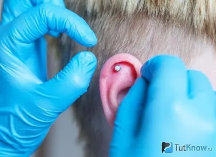 Piercing transzdermális implantátum helyének kiválasztása, oktatás, ellátás