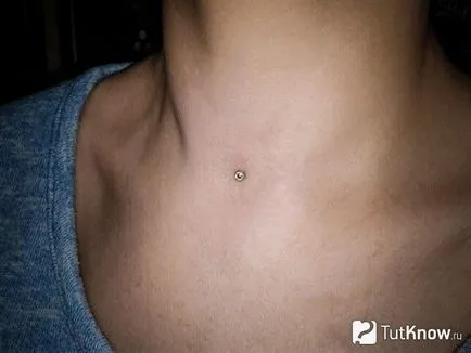 Piercing transzdermális implantátum helyének kiválasztása, oktatás, ellátás