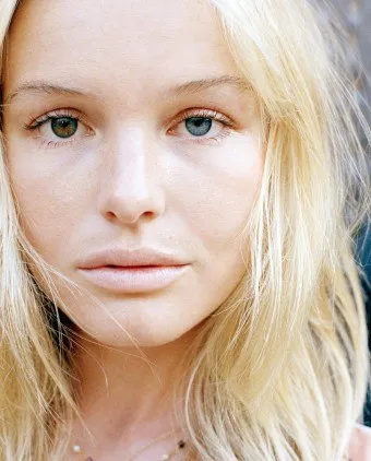 Miért különböző színű szemek okai heterochromia