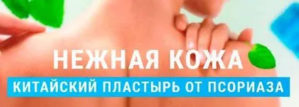 Psoriasis okai betegség és a kezelés