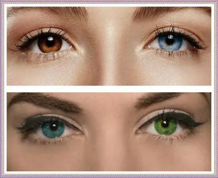 Különböző szemszín minden tudás heterochromia (különböző) Különböző szemszín minden tudás heterochromia