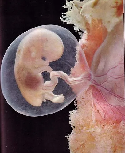 A gyermek az anyaméhben hetekig a fotó (terhesség hétről-hétre) A gyermek az anyaméhben hetekig fotó