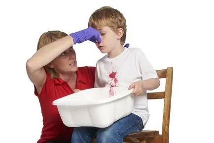 Snot vér - vér okait és nátha kezelésére (takony) Takony vér - okai és kezelése a közös hidegvérrel